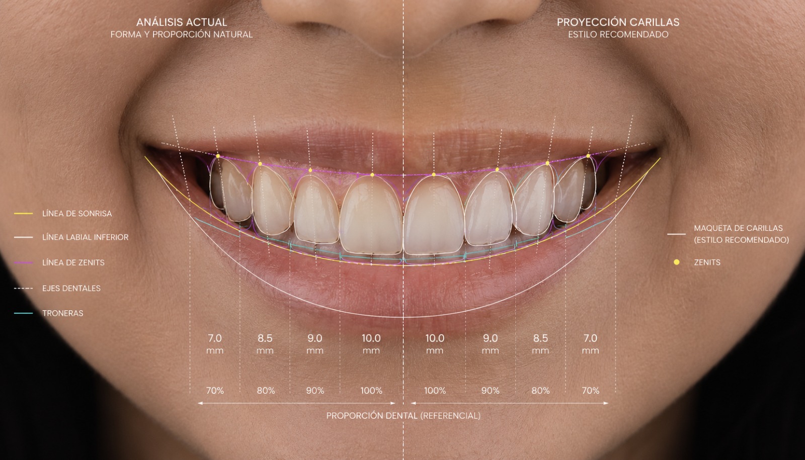 Promoción de diseño de sonrisa en COID