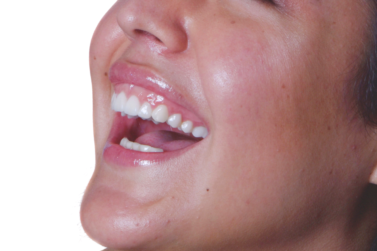 Sonrisa COID
